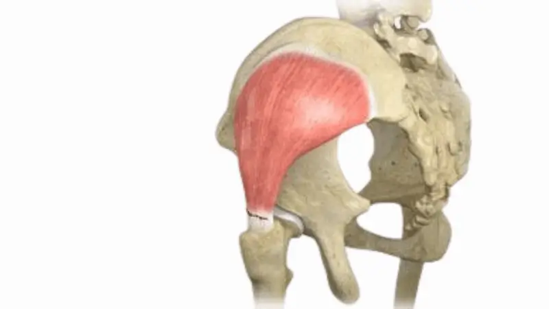 What to Expect After Gluteus Medius Tendon Repair Surgery