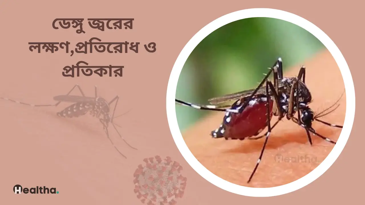 ডেঙ্গু জ্বরের লক্ষণ ও প্রতিরোধ