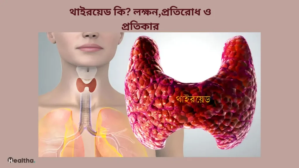 থাইরয়েড কি? লক্ষন,প্রতিরোধ ও প্রতিকার